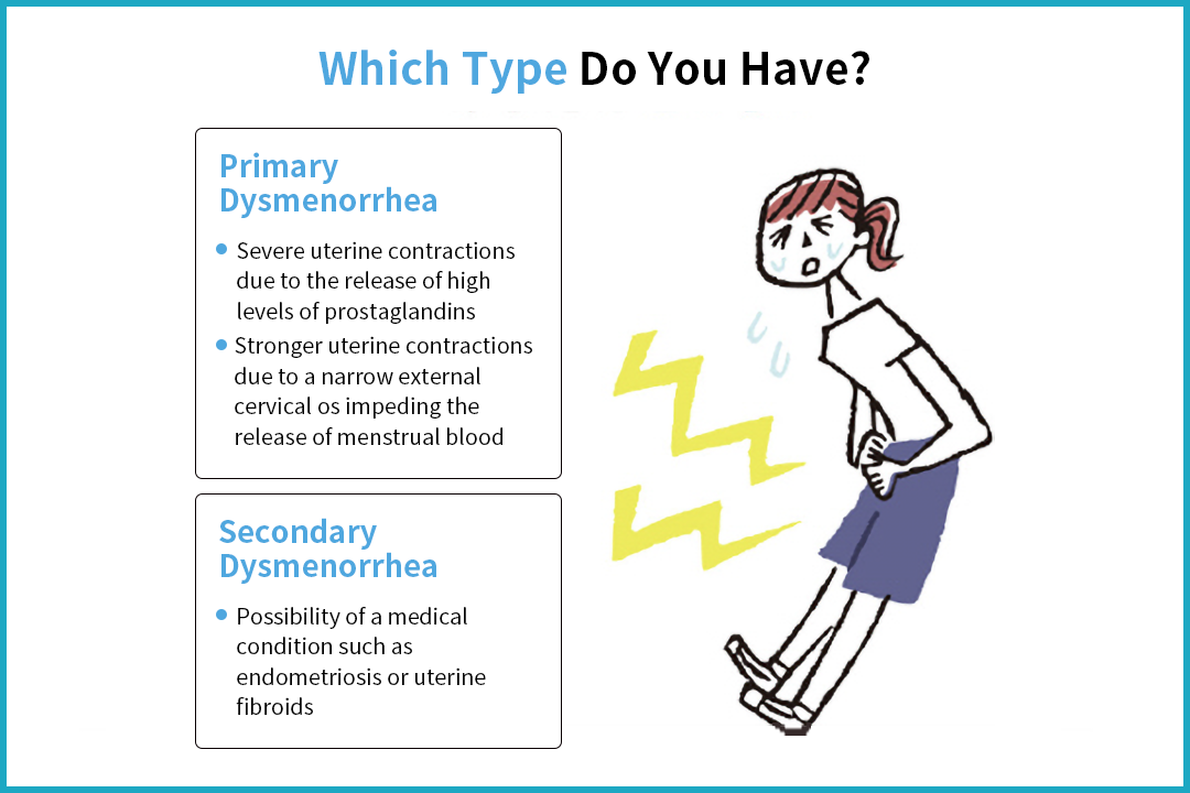 Causes for menstrual cramps (Dysmenorrhea)